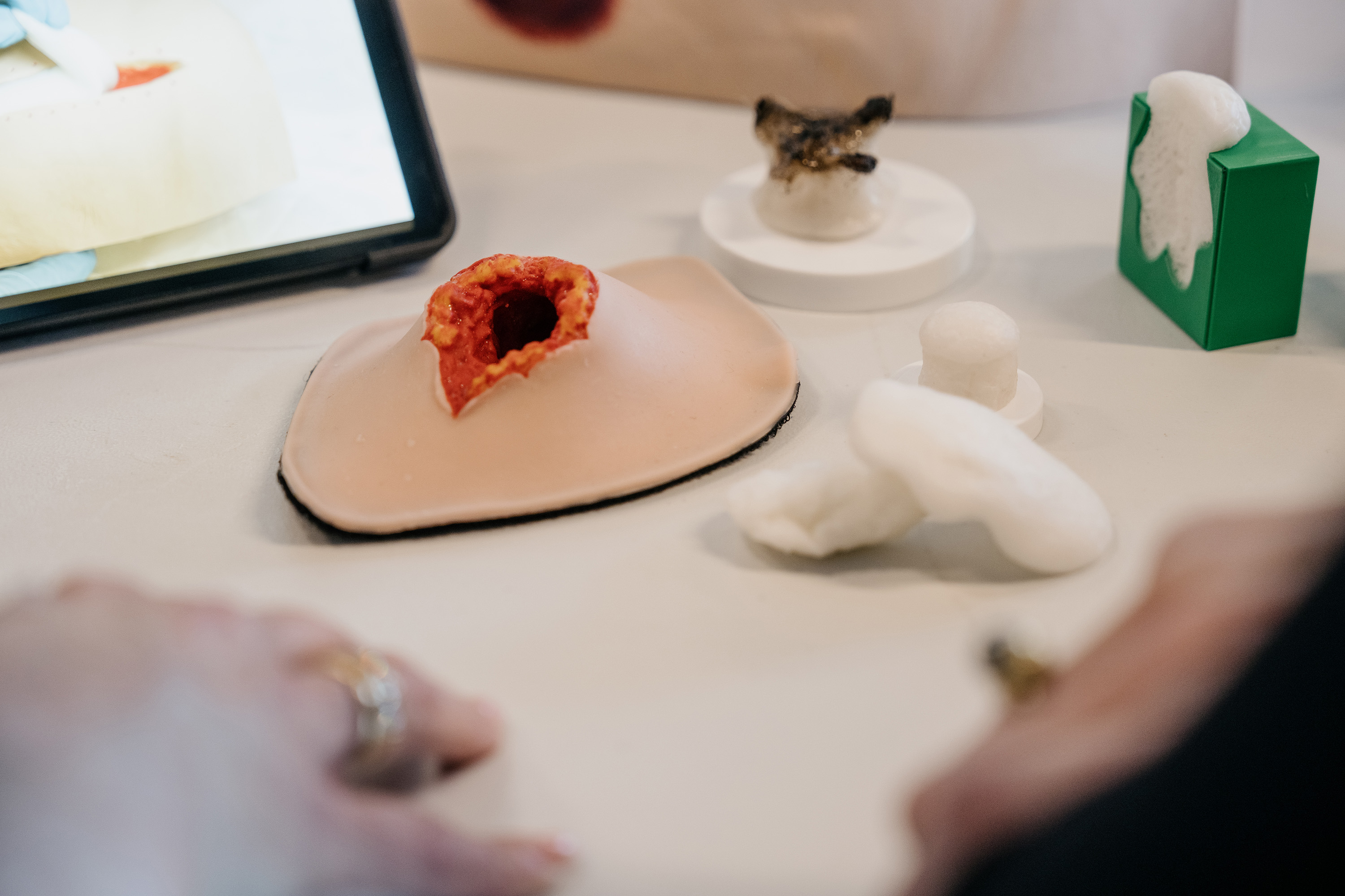 Nyt intelligent skum kan revolutionere sårpleje. Billede taget af Mathias Eis